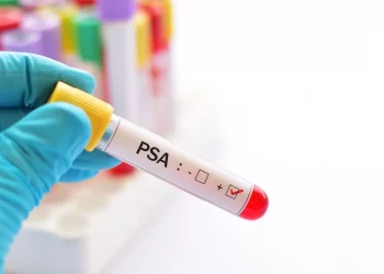 Novembro Azul: Prefeitura divulga cronograma para exames de PSA nas Unidades de Saúde