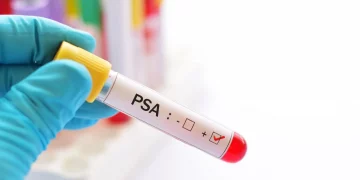 Novembro Azul: Prefeitura divulga cronograma para exames de PSA nas Unidades de Saúde